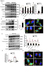 Golgin-97 Antibody in Immunocytochemistry (ICC/IF)