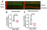 ASIC1 Antibody in Western Blot (WB)
