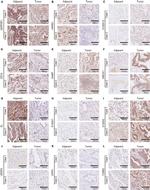 VIPR1 Antibody in Immunohistochemistry (IHC)