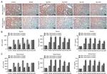 Apelin receptor Antibody in Immunohistochemistry (IHC)