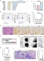 CDX2 Antibody in Immunohistochemistry (IHC)