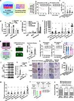 IBSP Antibody in Immunohistochemistry (IHC)