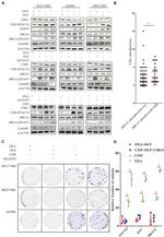 Phospho-BRCA1 (Ser1497) Antibody in Western Blot (WB)