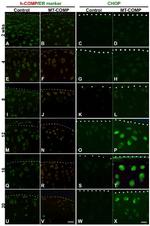 COMP Antibody in Immunohistochemistry (IHC)