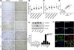 NFATC1 Antibody in Western Blot, Immunohistochemistry, Immunocytochemistry (WB, IHC, ICC/IF)