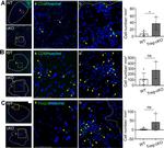 CD4 Antibody in Immunohistochemistry (Frozen) (IHC (F))