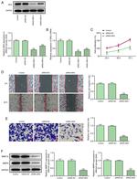 SIK2 Antibody in Western Blot (WB)