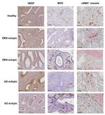 VEGF Antibody in Immunohistochemistry (IHC)