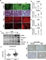 COL1A1 Antibody in Western Blot (WB)