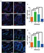 LGR5 Antibody in Immunohistochemistry, Immunocytochemistry (IHC, ICC/IF)