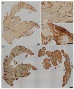 CD42b Antibody in Immunohistochemistry (IHC)