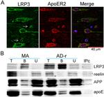ApoER2 Antibody in Immunohistochemistry, Immunohistochemistry (Paraffin), Immunocytochemistry (IHC, IHC (P), ICC/IF)