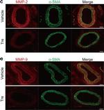 Rabbit IgG (H+L) Highly Cross-Adsorbed Secondary Antibody in Immunohistochemistry (Paraffin) (IHC (P))