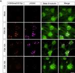 Rabbit IgG (H+L) Cross-Adsorbed Secondary Antibody in Immunocytochemistry (ICC/IF)