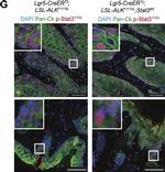 Rabbit IgG (H+L) Cross-Adsorbed Secondary Antibody in Immunohistochemistry (IHC)
