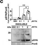 Goat IgG (H+L) Secondary Antibody in Western Blot (WB)