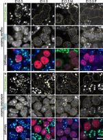 Human IgG (H+L) Cross-Adsorbed Secondary Antibody in Immunocytochemistry (ICC/IF)