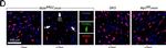 Mouse IgG (H+L) Cross-Adsorbed Secondary Antibody in Immunohistochemistry (IHC)