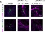 Rabbit IgG (H+L) Highly Cross-Adsorbed Secondary Antibody in Immunocytochemistry (ICC/IF)