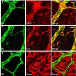 Goat IgG (H+L) Cross-Adsorbed Secondary Antibody in Immunocytochemistry (ICC/IF)