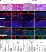 MUC5AC Antibody in Immunohistochemistry (IHC)