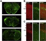 NECAB1 Antibody in Immunohistochemistry (IHC)