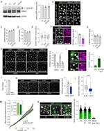 SUV39H1 Antibody in Immunocytochemistry (ICC/IF)