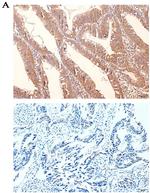 CDCA7 Antibody in Immunohistochemistry (IHC)