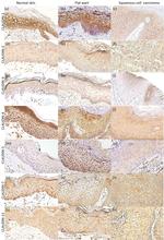 Claudin 3 Antibody in Immunohistochemistry (IHC)