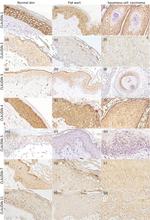 Claudin 3 Antibody in Immunohistochemistry (IHC)