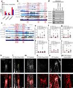 PRICKLE1 Antibody in Immunohistochemistry (IHC)