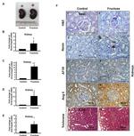 Renin Antibody in Immunohistochemistry (IHC)