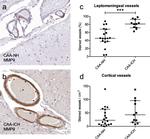 MMP9 Antibody in Immunohistochemistry (IHC)