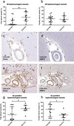 MMP9 Antibody in Immunohistochemistry (IHC)