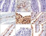 MMP9 Antibody in Immunohistochemistry (IHC)