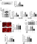 Phospho-MYLK (Ser1760) Antibody in Western Blot (WB)