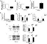 COL15A1 Antibody in Western Blot (WB)