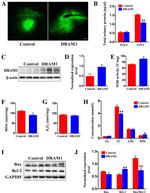 DRAM Antibody in Western Blot (WB)