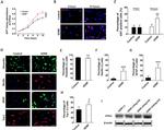 Beta III Tubulin Antibody in Immunocytochemistry (ICC/IF)