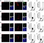 Beta III Tubulin Antibody in Immunocytochemistry (ICC/IF)