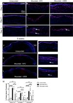 CD45 Antibody in Immunohistochemistry (IHC)