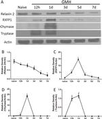 Relaxin 2 Antibody in Western Blot (WB)