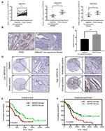 DEPDC1B Antibody in Immunohistochemistry (IHC)