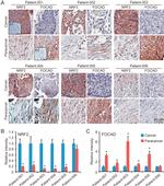 FOCAD Antibody in Immunohistochemistry (IHC)
