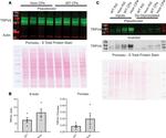 TRPV4 Antibody in Western Blot (WB)