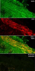 SVEP1 Antibody in Immunohistochemistry (IHC)