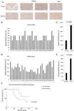 RHPN2 Antibody in Immunohistochemistry (IHC)