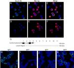 SEZ6L2 Antibody in Western Blot, Immunoprecipitation (WB, IP)