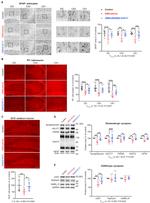 VGAT Antibody in Western Blot (WB)