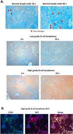 TNFRSF19L Antibody in Immunohistochemistry (IHC)